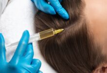 از ریزش مو تا رویش دوباره: چگونه پی آر پی مو زندگی موهای شما را تغییر میدهد از ریزش مو تا رویش دوباره: چگونه پی آر پی مو زندگی موهای شما را تغییر میدهد