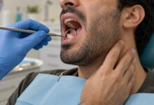 عفونت دندان عقل و گلو درد؛ چه زمانی باید جدی گرفت؟ معاینه دندان عقل بیمار با درد زیر فک و گلو در مطب دندانپزشکی